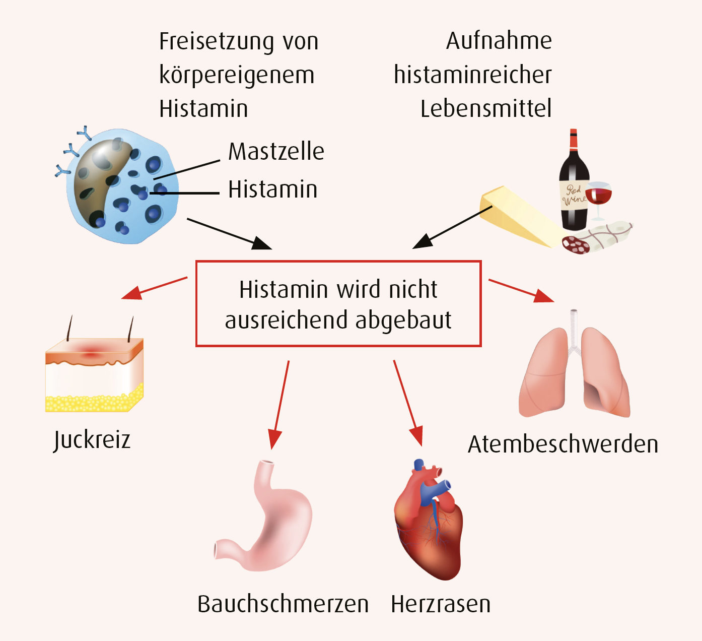 Histaminintoleranz – Die Unverträglichkeit Verstehen | A.Vogel